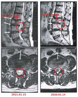 .MRI_2021.01.15..jpg
